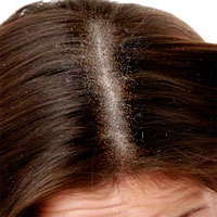 ��� ���������� �� �������